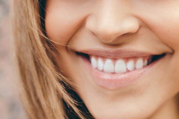 Fix Crooked Teeth