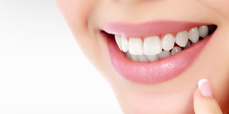 Teeth Whitening in Hyderabad