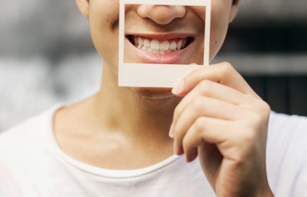 Asian Guy Holding Photo Frame Smiling Smile Makeover Best Dental Implants in Hyderabad