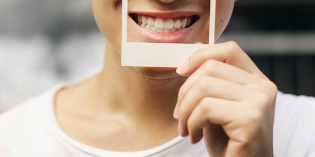 Smile Makeover Best Dental Implants in Hyderabad