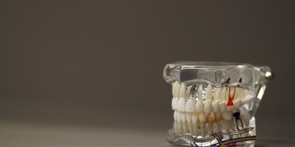 root-canal-treatment-hyderabad Root Canal Treatment Hyderabad