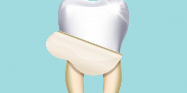 dental-veneer-featured Dental Veneers
