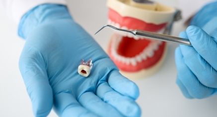 Why is it important to have a root canal at the topped enamel?