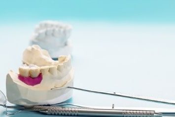 Bridges Vs Single Tooth Bridge - -positivedental