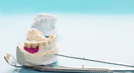 Dental Bridges vs Unmarried Enamel Bridge