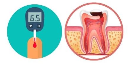 Dental Implants for Diabetics - Positivedental