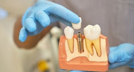 Are Dental Implants for Seniors Worthy?